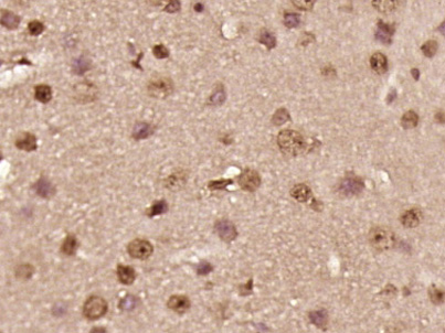 14 - TNRC18 Rabbit pAb AP56967