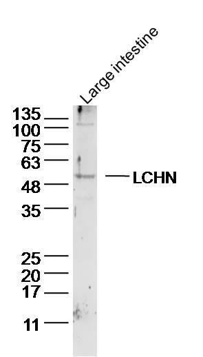1 - LCHN Rabbit pAb AP56982