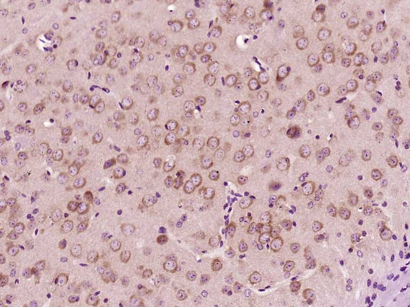 14 - LCHN Rabbit pAb AP56982