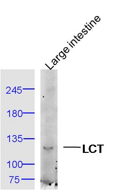 1 - LCT Rabbit pAb AP56987