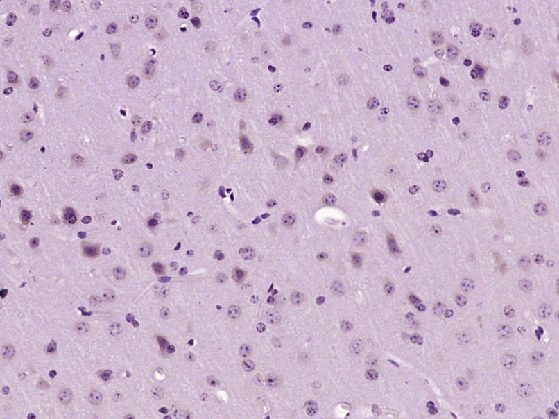 14 - PGAM5 Rabbit pAb AP57001
