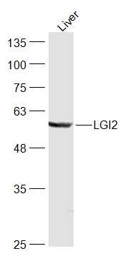1 - LGI2 Rabbit pAb AP57005