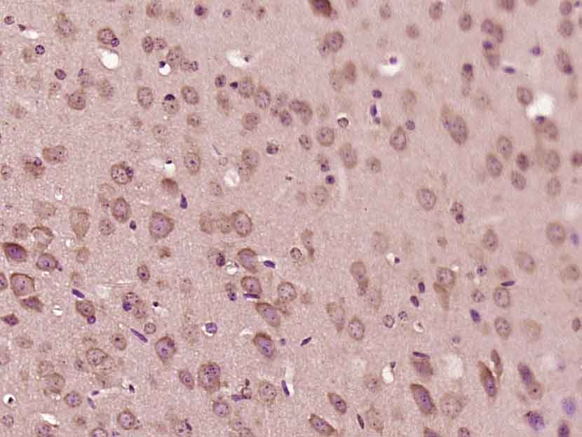 14 - LGI2 Rabbit pAb AP57005