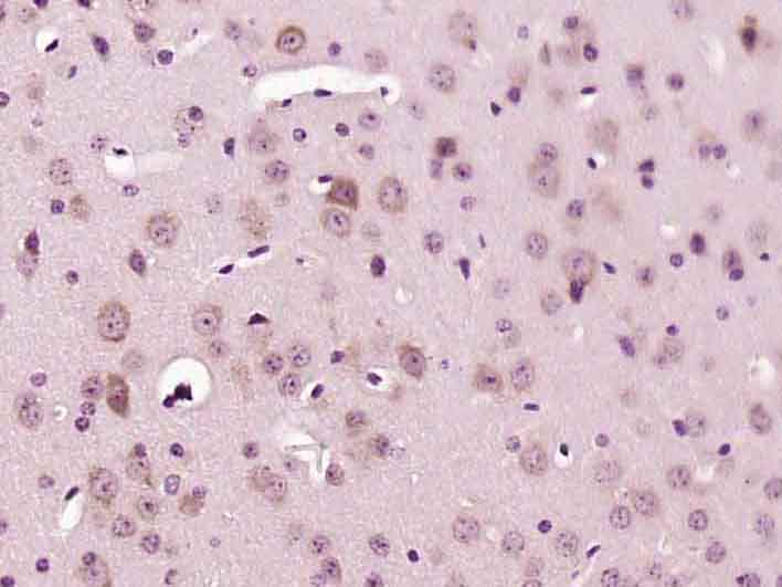 14 - LIMCH1 Rabbit pAb AP57015