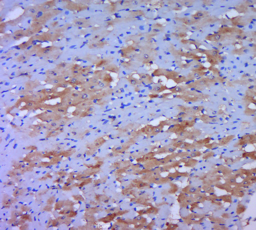 14 - DLD Rabbit pAb AP57025