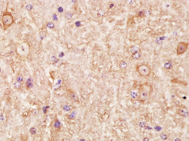 14 - LMAN1L Rabbit pAb AP57030