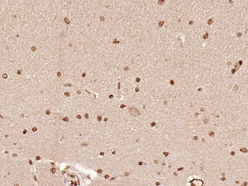 14 - LMO1 Rabbit pAb AP57036