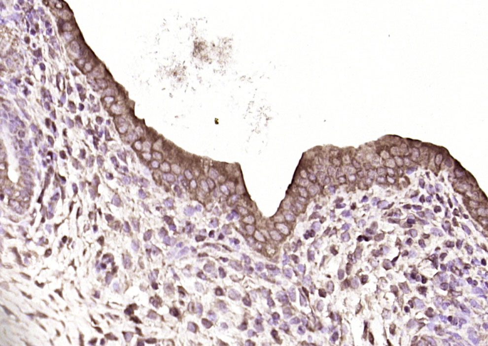 14 - SAKS1/2B28 Rabbit pAb AP57044