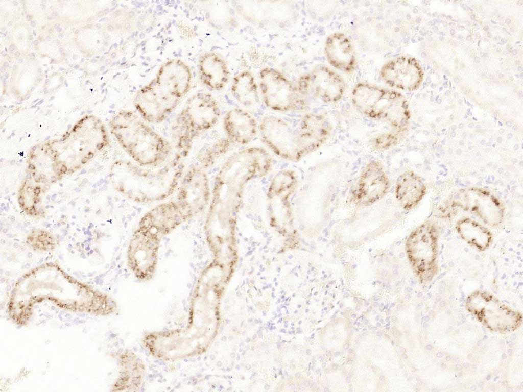 14 - LPHN1 Rabbit pAb AP57052