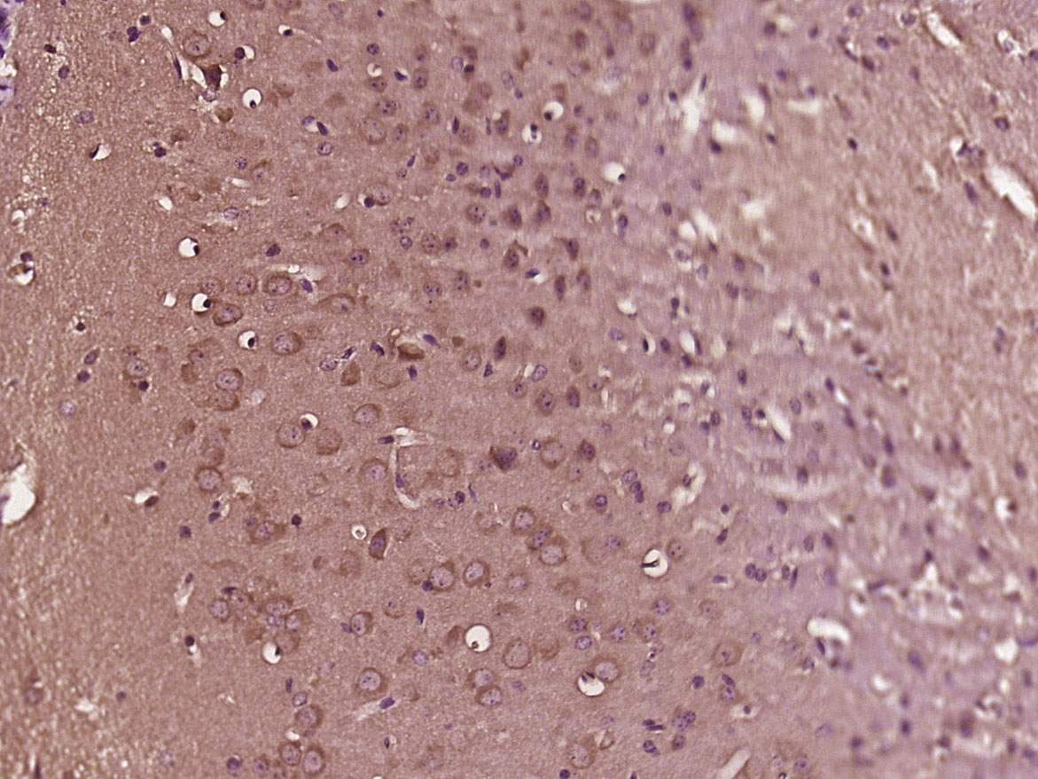 14 - LRRC20 Rabbit pAb AP57065