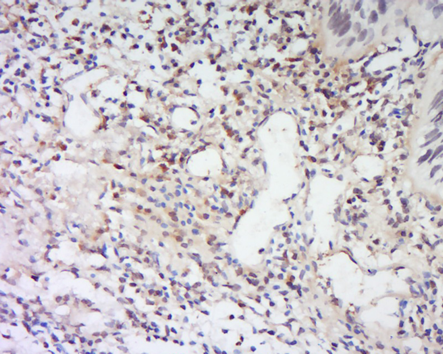 14 - LRRC26 Rabbit pAb AP57067