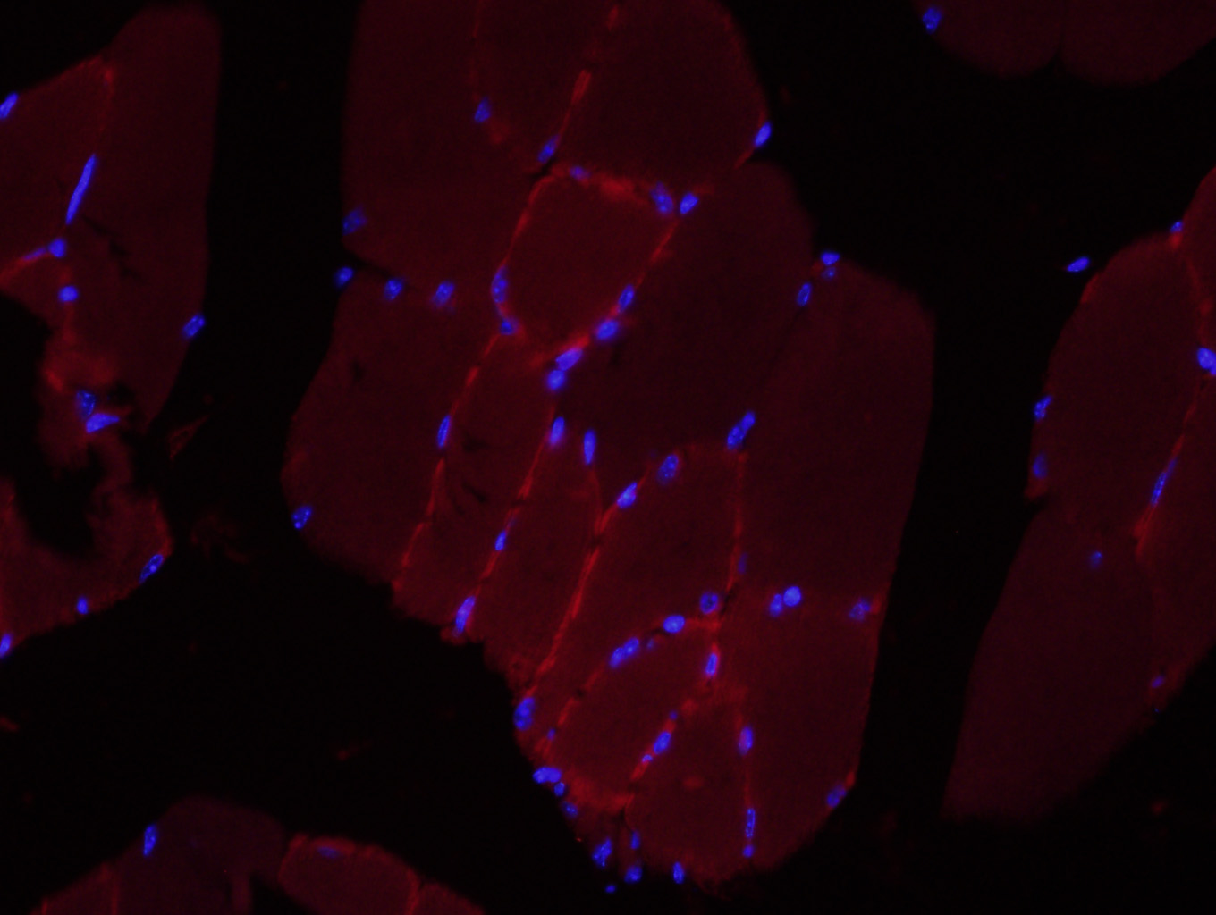 3 - LRRC33 Rabbit pAb AP57070