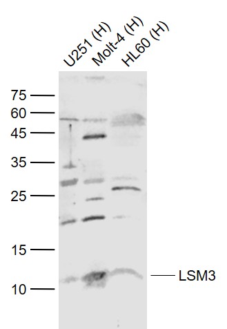 1 - LSM3 Rabbit pAb AP57075