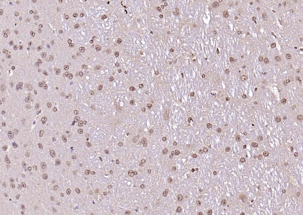14 - LSM3 Rabbit pAb AP57075
