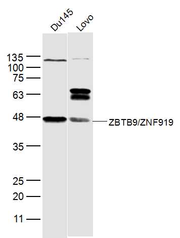 1 - ZBTB9/ZNF919 Rabbit pAb AP57092