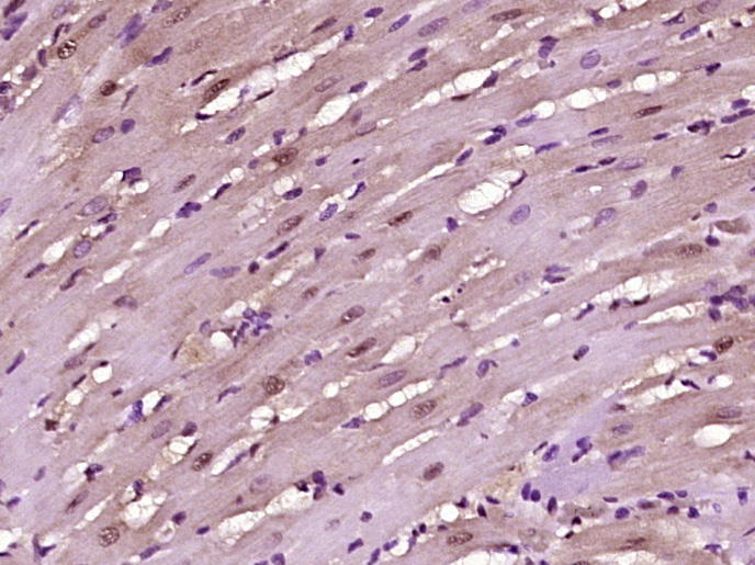14 - ZBTB9/ZNF919 Rabbit pAb AP57092