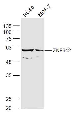 1 - ZNF642 Rabbit pAb AP57121
