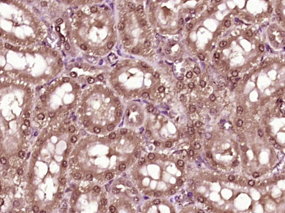 14 - ZFAND2B Rabbit pAb AP57126