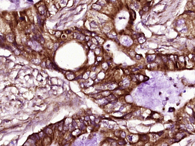 14 - ZC3HAV1L/C7orf39 Rabbit pAb AP57135