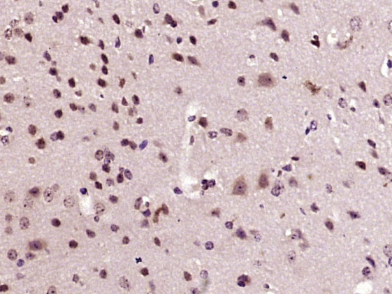 14 - ZCCHC10 Rabbit pAb AP57136