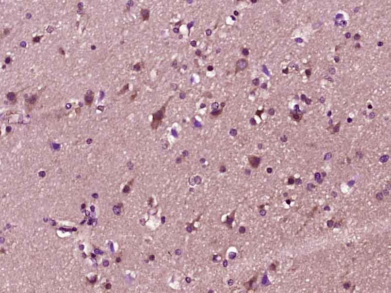 14 - MACF1/ACF7 Rabbit pAb AP57139