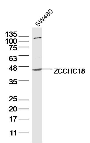 1 - ZCCHC18 Rabbit pAb AP57141