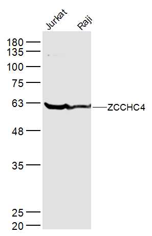 1 - ZCCHC4 Rabbit pAb AP57143
