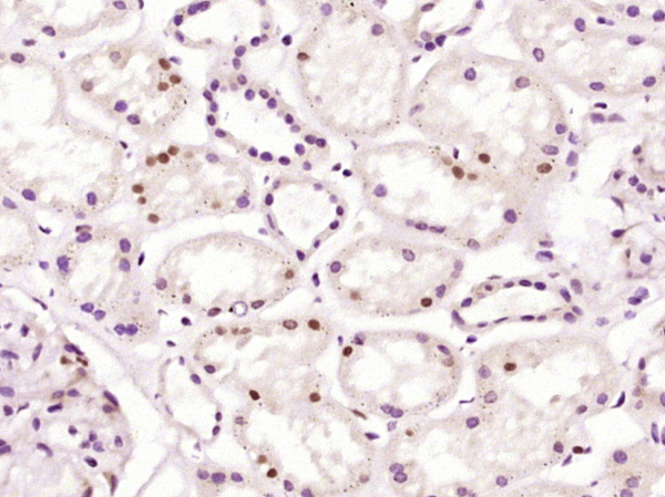 14 - ZCCHC4 Rabbit pAb AP57143