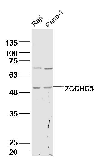 1 - ZCCHC5 Rabbit pAb AP57144