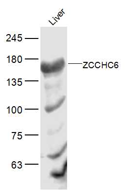 1 - ZCCHC6 Rabbit pAb AP57145