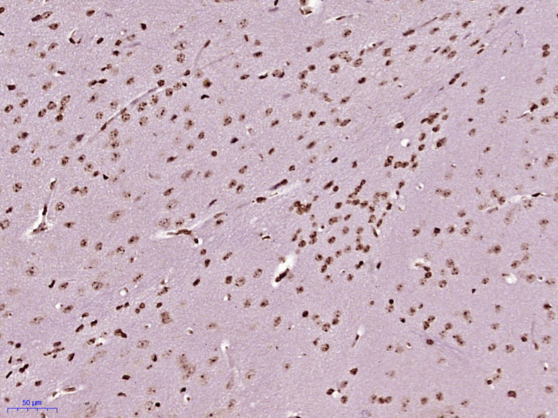 14 - ZCCHC6 Rabbit pAb AP57145