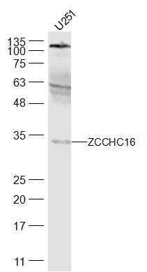 1 - ZCCHC16 Rabbit pAb AP57147