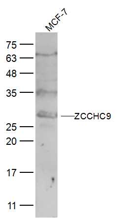 1 - ZCCHC9 Rabbit pAb AP57150