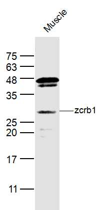 1 - zcrb1 Rabbit pAb AP57154
