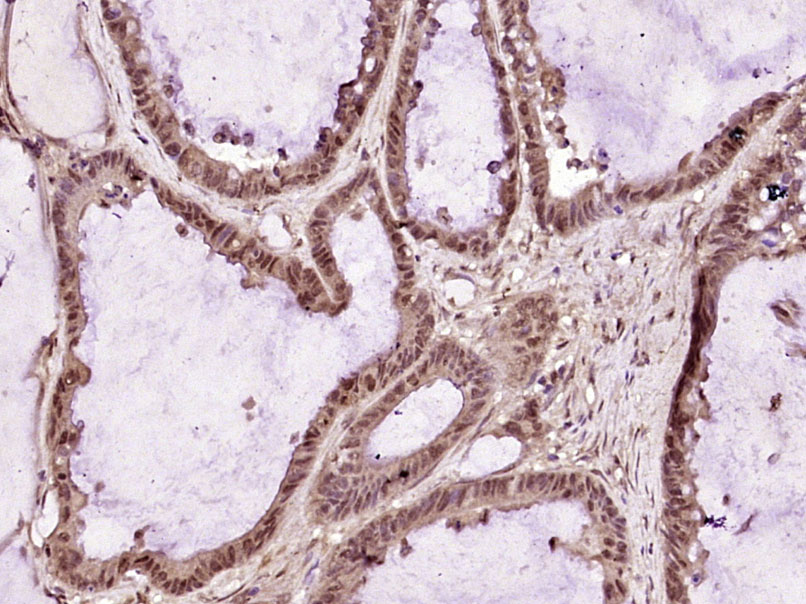 14 - MACROD1 Rabbit pAb AP57173