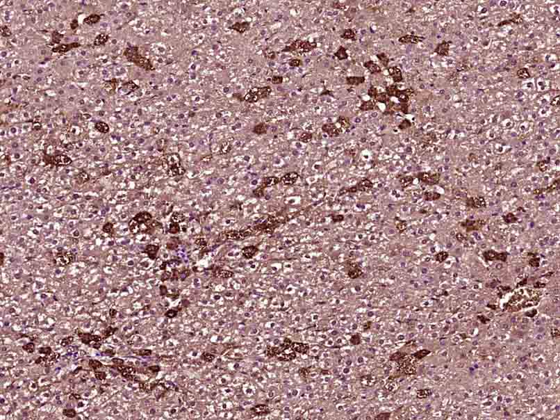 14 - SARDH Rabbit pAb AP57175