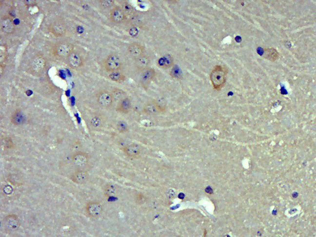 14 - MAN2B1 Rabbit pAb AP57198