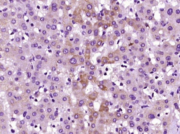 14 - MANEA Rabbit pAb AP57201