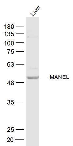 1 - MANEL Rabbit pAb AP57202