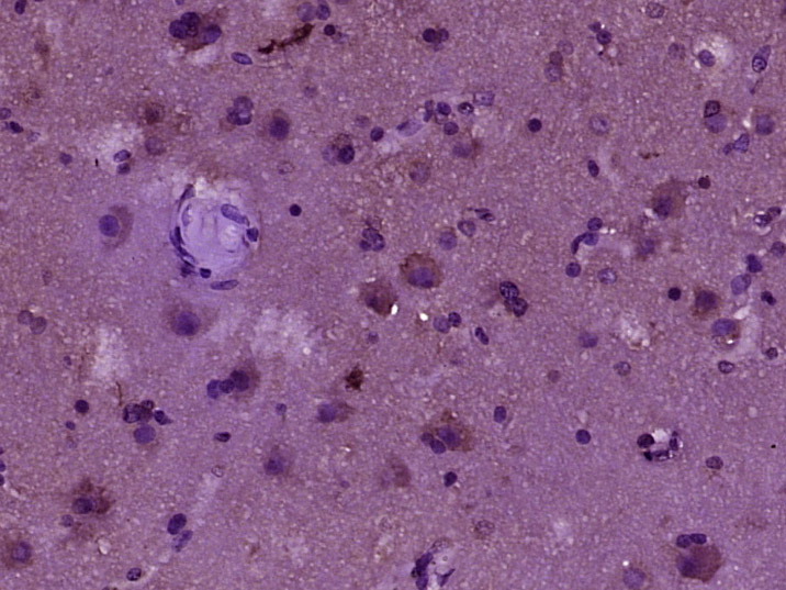 14 - MAP1D Rabbit pAb AP57207