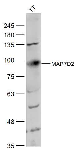 1 - MAP7D2 Rabbit pAb AP57209