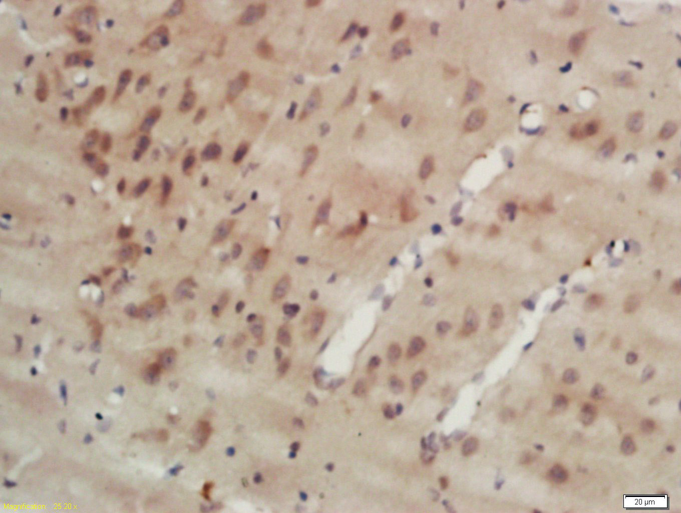 14 - MAPRE1 Rabbit pAb AP57211