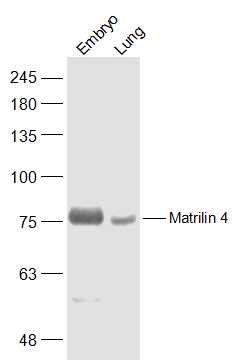 1 - Matrilin 4 Rabbit pAb AP57218