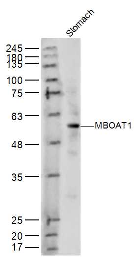 1 - MBOAT1 Rabbit pAb AP57222