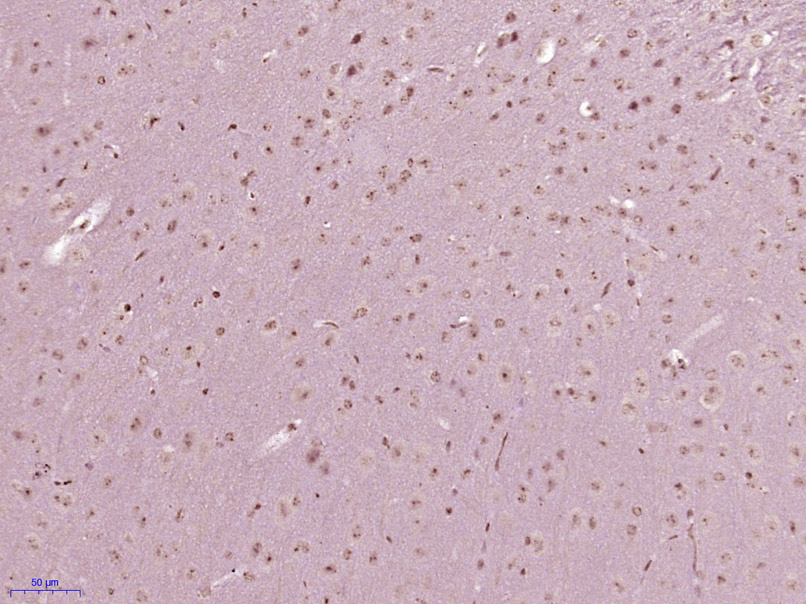 14 - MBTD1 Rabbit pAb AP57223