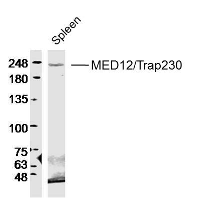 1 - MED12/Trap230 Rabbit pAb AP57238