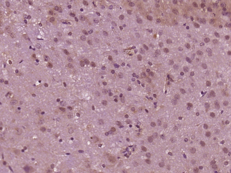 14 - MED12/Trap230 Rabbit pAb AP57238