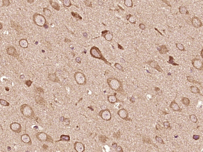 14 - MEX3D/RNF193 Rabbit pAb AP57265
