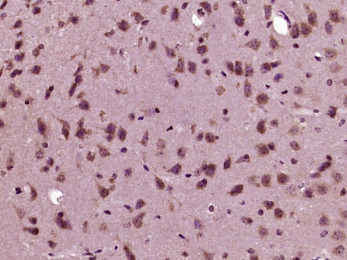 14 - RRNAD1 Rabbit pAb AP57273