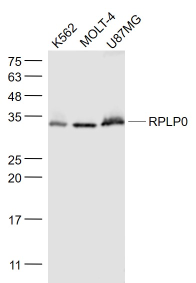1 - RPLP0 Rabbit pAb AP57282